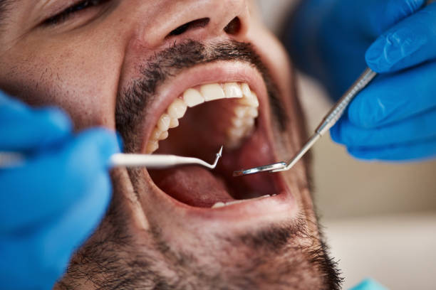 Best Emergency Broken Tooth Repair in Stephenville, TX